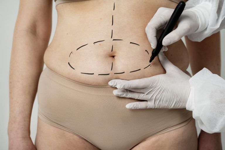 Lipo 360