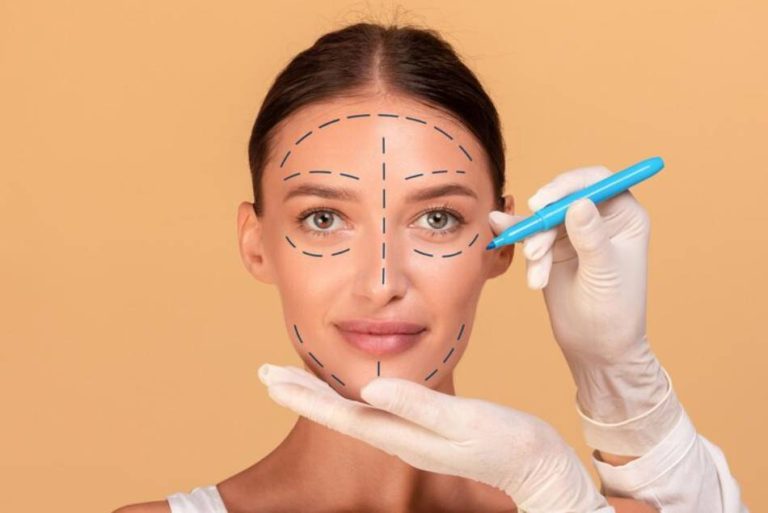 Lifting facial