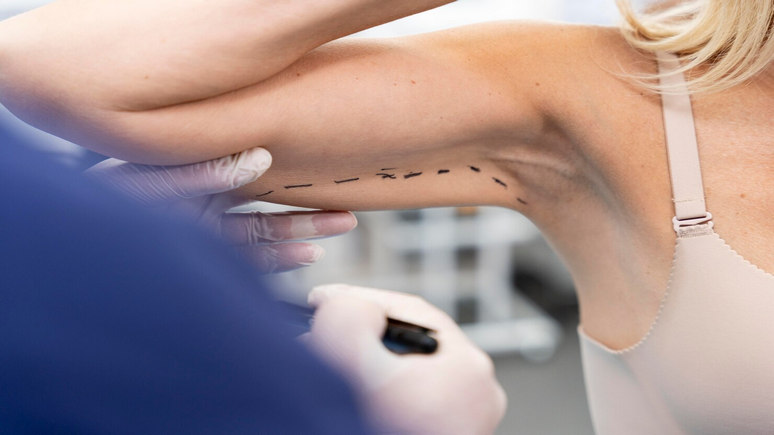 Surgical Treatments for Sagging Arms