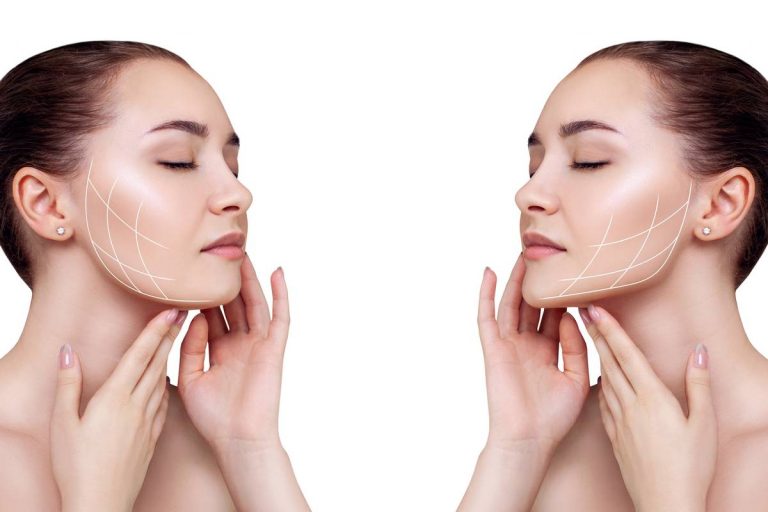 Liposucción facial, la guía definitiva
