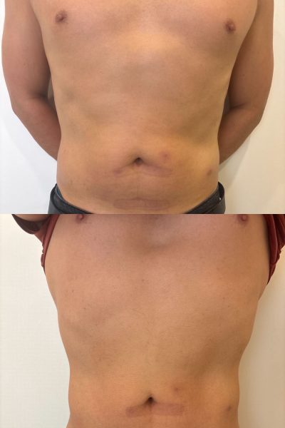 before&after_accent_prime