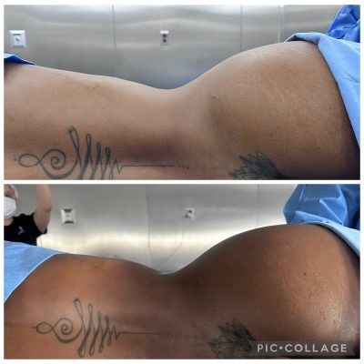 ribxcar antes y despues