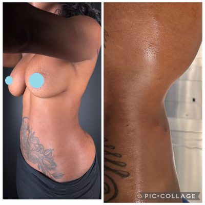 ribxcar antes y despues1