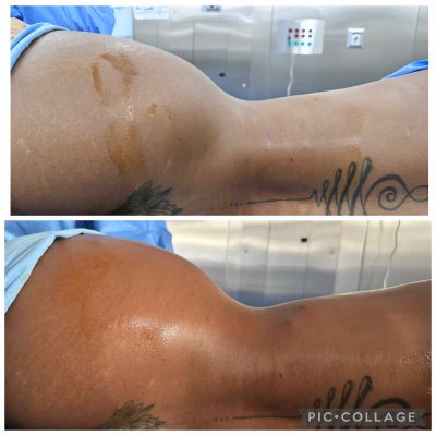 ribxcar antes y despues2